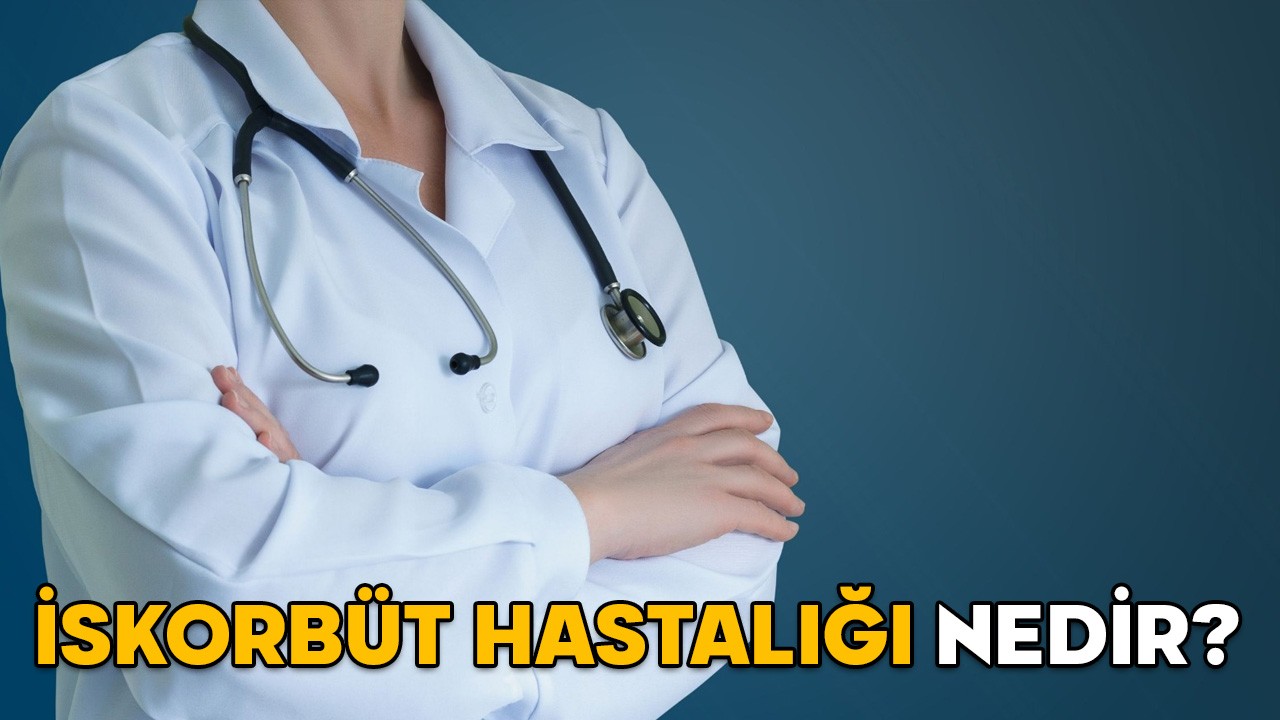 İSKORBÜT HASTALIĞI NEDİR, NASIL OLUR? Robbie Williams’ın yakalandığı iskorbüt (Skorbüt) hastalığının nedenleri ve belirtileri neler?