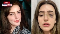 'Teğmen eşini darp etti' iddiası Ankara'ya uzandı!