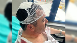 YRP'lilerin baş yarmalı kavgasına tutuklama kararı!