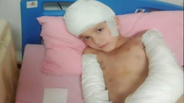 Köpek saldırına uğramıştı! Mahkeme beraat gerekçesini açıkladı