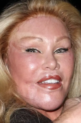 'Kedi Kadın' olarak tanınıyordu! Gençlik hallerini görenler 'ne yaptın sen kendine' dedi - Resim: 1