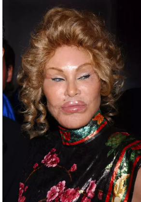 'Kedi Kadın' olarak tanınıyordu! Gençlik hallerini görenler 'ne yaptın sen kendine' dedi - Resim: 2