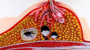 Kolesterolünüzü silip süpürüyor! Haftada bir gün yediğinizde kanınız adeta yıkanıyor!