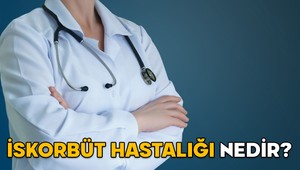 İSKORBÜT HASTALIĞI NEDİR, NASIL OLUR? Robbie Williams’ın yakalandığı iskorbüt (Skorbüt) hastalığının nedenleri ve belirtileri neler?