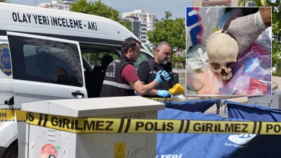 Görüntüler dehşete düşürdü! Çöpte çocuğa ait kafatası bulundu