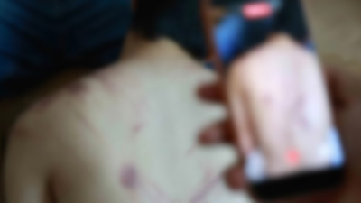 Elazığ'da rehabilitasyon merkezinde skandal "şiddet" iddiası! Soruşturma başlatıldı