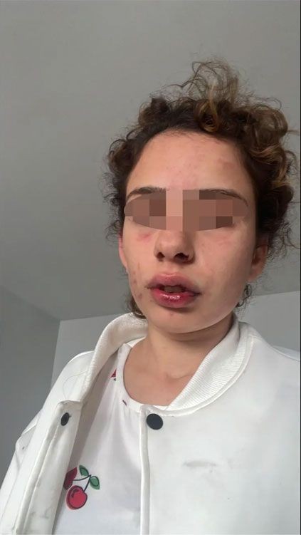 Eski sevgilisine dehşeti yaşatıp serbest kalmıştı… İddianame hazır - Resim: 5