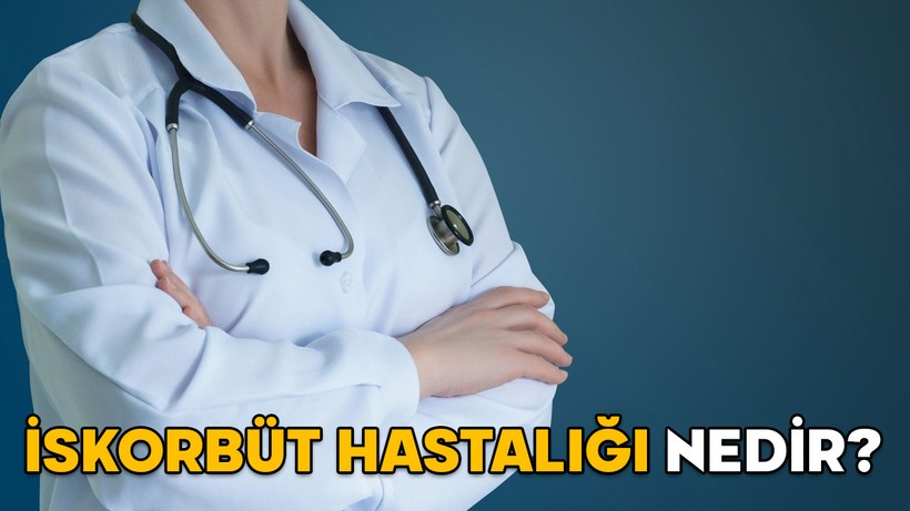 İSKORBÜT HASTALIĞI NEDİR, NASIL OLUR? Robbie Williams’ın yakalandığı iskorbüt (Skorbüt) hastalığının nedenleri ve belirtileri neler?