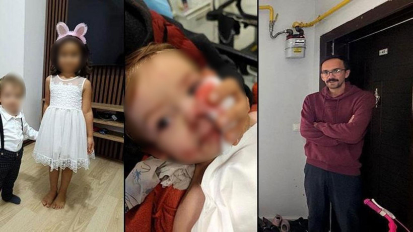 Ankara'da 2 çocuğa saldıran köpeğin sahibi tutuklandı!