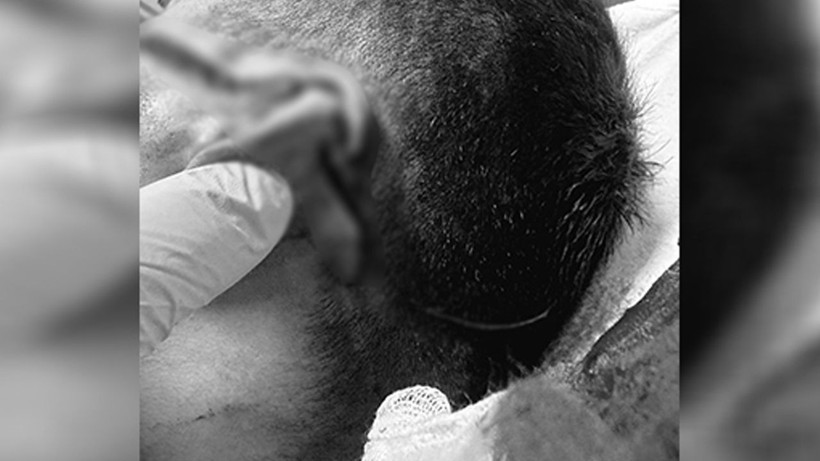 Bakan Yılmaz Tunç'tan geçmiş olsun mesajı! Sağlıklarına kavuşma temennisinde bulundu - Resim: 2